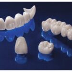 dental crowns